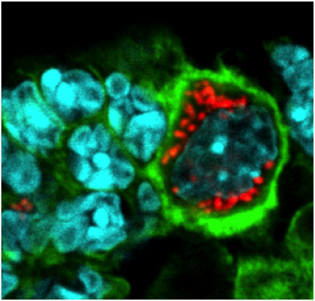  Conférence - Brucella biology meeting